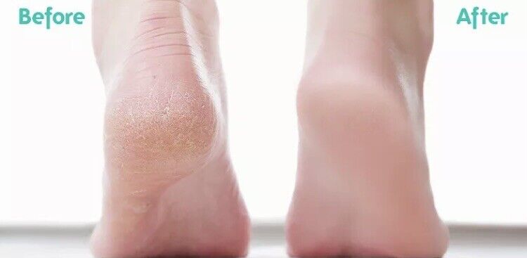 FRESH FEET Cleans & Foot Massager NO BENDING Scrub Clean Wash AS SEEN ON TV NEW